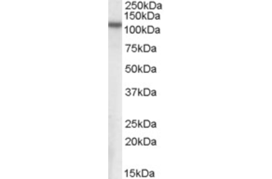 Western Blot - Anti-NPEPPS Antibody (A84420) - Antibodies.com