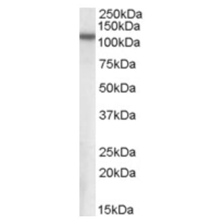 Western Blot - Anti-NPEPPS Antibody (A84420) - Antibodies.com