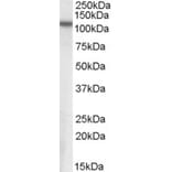 Western Blot - Anti-NPEPPS Antibody (A84420) - Antibodies.com