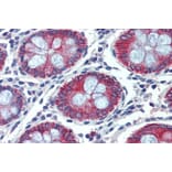Immunohistochemistry - Anti-EPB41L2 Antibody (A84421) - Antibodies.com