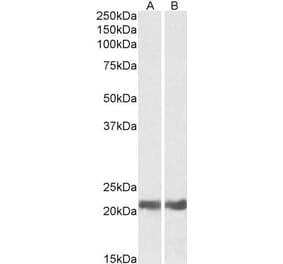 Western Blot - Anti-alpha B Crystallin Antibody (A84423) - Antibodies.com