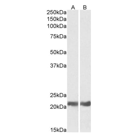Western Blot - Anti-alpha B Crystallin Antibody (A84423) - Antibodies.com