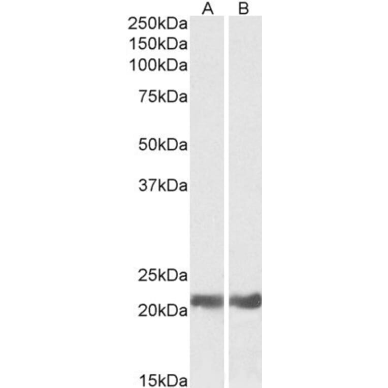 Western Blot - Anti-alpha B Crystallin Antibody (A84423) - Antibodies.com