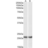 Western Blot - Anti-alpha B Crystallin Antibody (A84423) - Antibodies.com