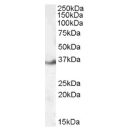 Western Blot - Anti-LASP1 Antibody (A84426) - Antibodies.com