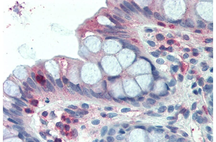 Immunohistochemistry - Anti-LASP1 Antibody (A84426) - Antibodies.com