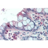 Immunohistochemistry - Anti-LASP1 Antibody (A84426) - Antibodies.com