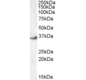 Western Blot - Anti-LASP1 Antibody (A84426) - Antibodies.com