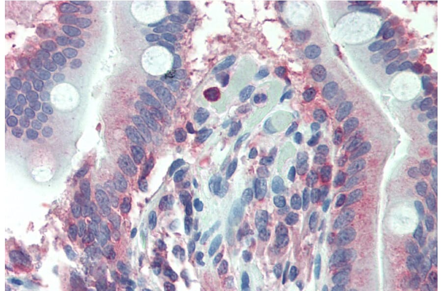 Immunohistochemistry - Anti-LASP1 Antibody (A84426) - Antibodies.com