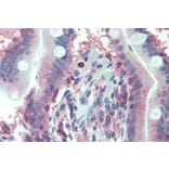 Immunohistochemistry - Anti-LASP1 Antibody (A84426) - Antibodies.com