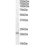 Western Blot - Anti-ARMET/ARP Antibody (A84427) - Antibodies.com