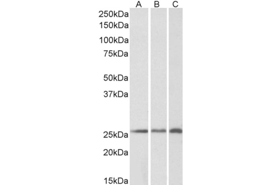 Western Blot - Anti-CSRP2/Dlp1 Antibody (A84429) - Antibodies.com