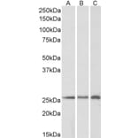 Western Blot - Anti-CSRP2/Dlp1 Antibody (A84429) - Antibodies.com