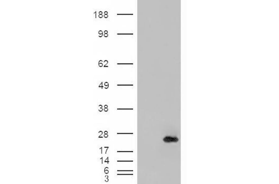 Western Blot - Anti-CSRP2/Dlp1 Antibody (A84429) - Antibodies.com