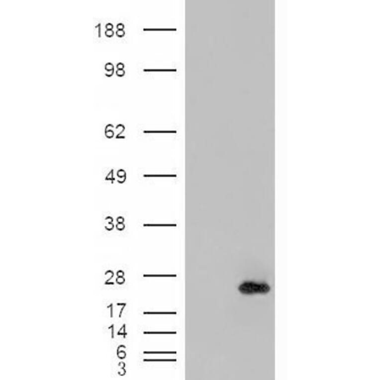 Western Blot - Anti-CSRP2/Dlp1 Antibody (A84429) - Antibodies.com