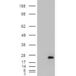 Western Blot - Anti-CSRP2/Dlp1 Antibody (A84429) - Antibodies.com