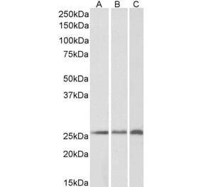 Western Blot - Anti-CSRP2 Antibody (A84429) - Antibodies.com
