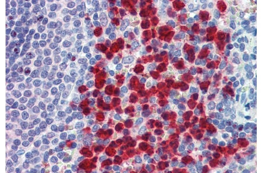 Immunohistochemistry - Anti-Cell Adhesion Molecule 4 Antibody (A84431) - Antibodies.com