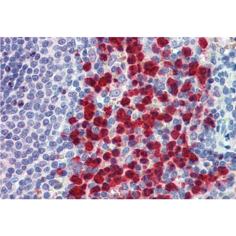 Immunohistochemistry - Anti-Cell Adhesion Molecule 4 Antibody (A84431) - Antibodies.com