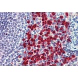 Immunohistochemistry - Anti-Cell Adhesion Molecule 4 Antibody (A84431) - Antibodies.com