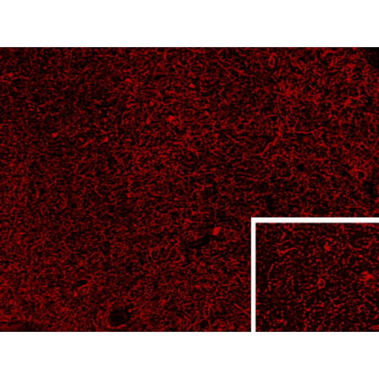 Immunohistochemistry - Anti-Proenkephalin Antibody (A84432) - Antibodies.com