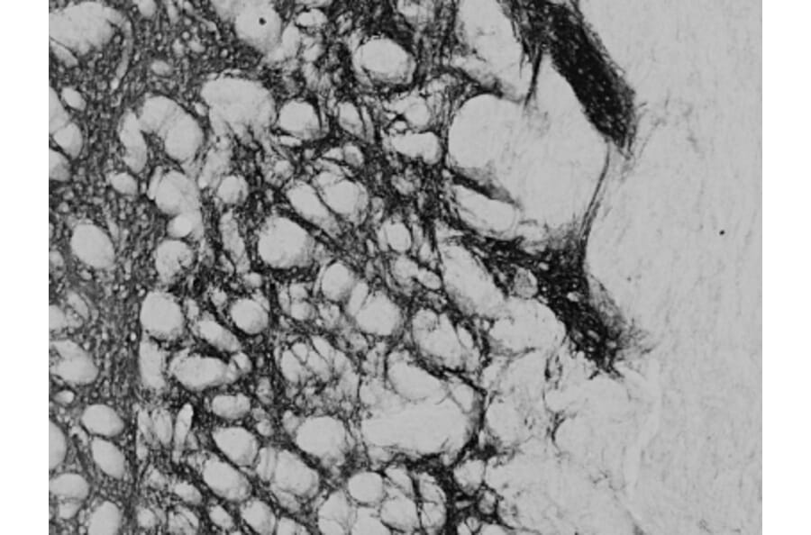 Immunohistochemistry - Anti-Proenkephalin Antibody (A84433) - Antibodies.com