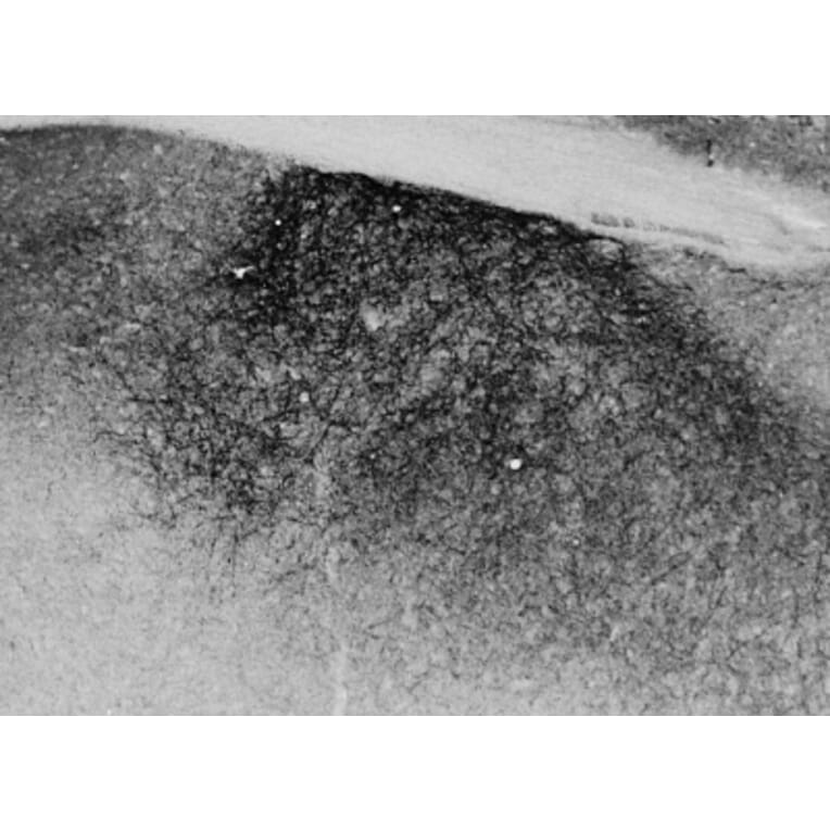 Immunohistochemistry - Anti-Proenkephalin Antibody (A84433) - Antibodies.com