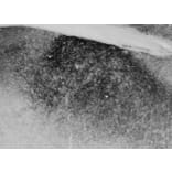 Immunohistochemistry - Anti-Proenkephalin Antibody (A84433) - Antibodies.com