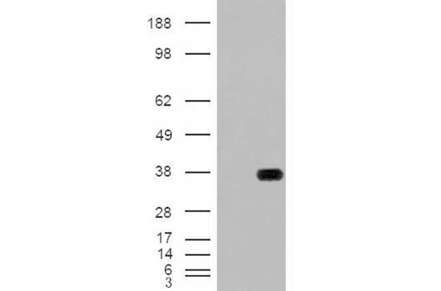 Western Blot - Anti-HADH Antibody (A84434) - Antibodies.com