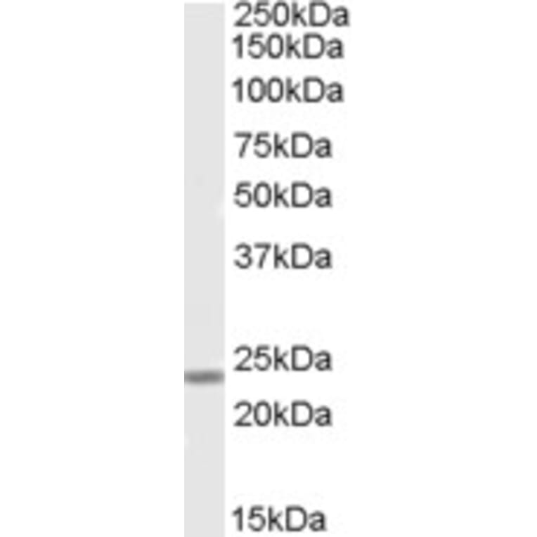 Western Blot - Anti-SOX15 Antibody (A84440) - Antibodies.com