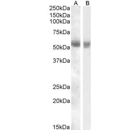 Western Blot - Anti-TMPRSS2 Antibody (A84441) - Antibodies.com