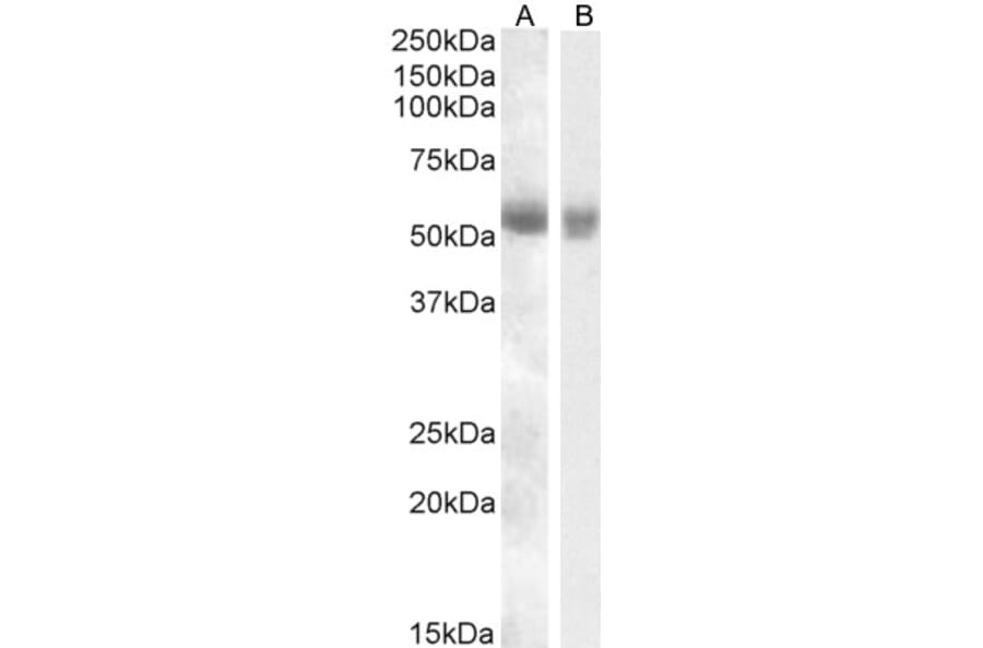 Western Blot - Anti-TMPRSS2 Antibody (A84441) - Antibodies.com