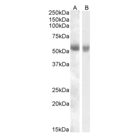 Western Blot - Anti-TMPRSS2 Antibody (A84441) - Antibodies.com