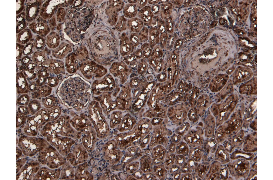 Immunohistochemistry - Anti-TMPRSS2 Antibody (A84441) - Antibodies.com