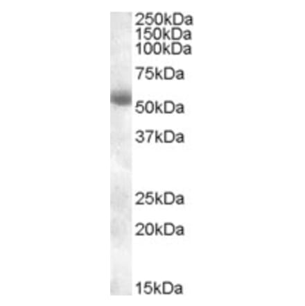 Western Blot - Anti-TMPRSS2 Antibody (A84441) - Antibodies.com
