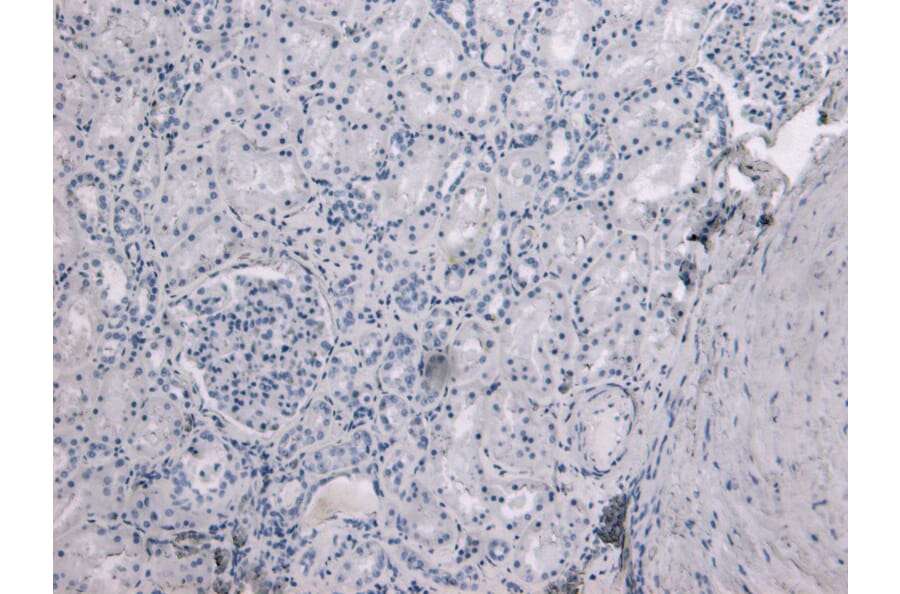 Immunohistochemistry - Anti-TMPRSS2 Antibody (A84441) - Antibodies.com