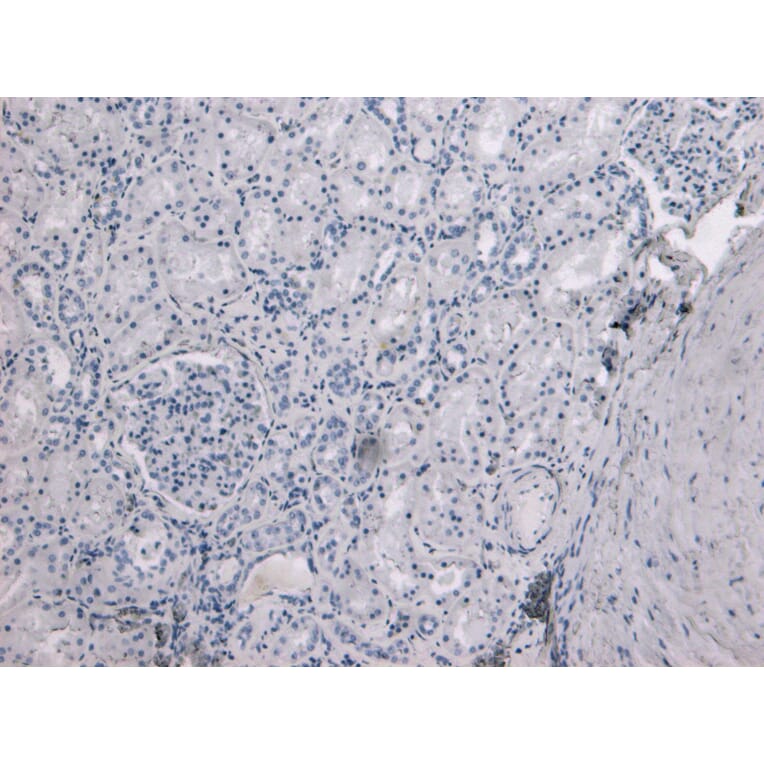 Immunohistochemistry - Anti-TMPRSS2 Antibody (A84441) - Antibodies.com