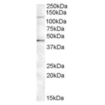 Western Blot - Anti-Tankyrase 2 Antibody (A84442) - Antibodies.com