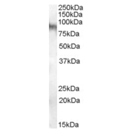 Western Blot - Anti-Neuroligin 3 Antibody (A84443) - Antibodies.com