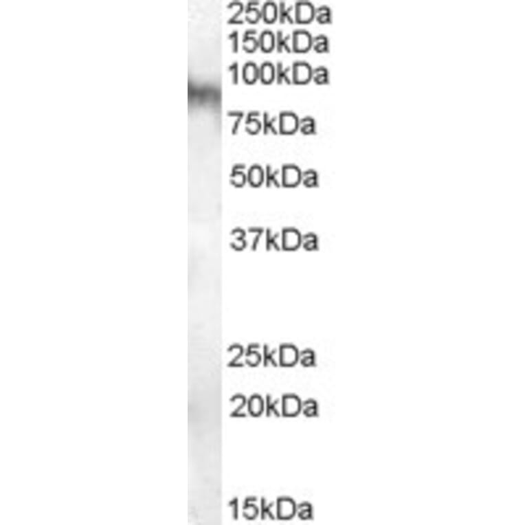 Western Blot - Anti-Neuroligin 3 Antibody (A84443) - Antibodies.com