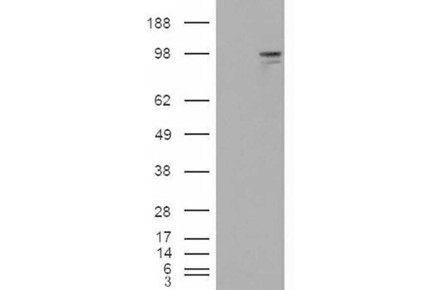 Western Blot - Anti-Neuroligin 3 Antibody (A84443) - Antibodies.com