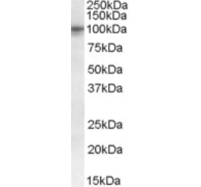 Western Blot - Anti-GPCR TAS1R2 Antibody (A84444) - Antibodies.com