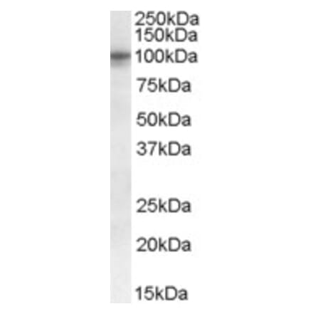 Western Blot - Anti-GPCR TAS1R2 Antibody (A84444) - Antibodies.com