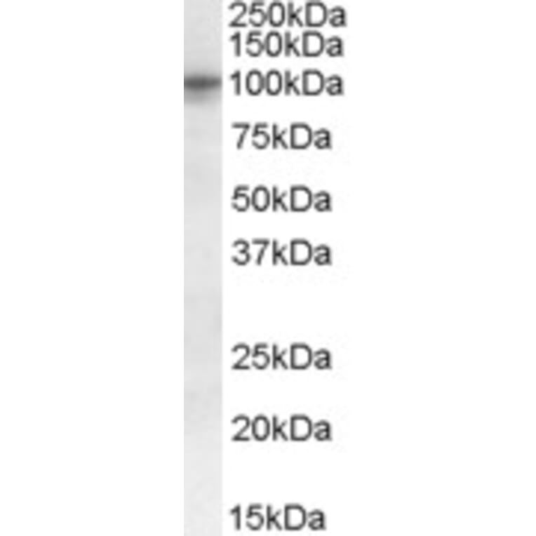 Western Blot - Anti-GPCR TAS1R2 Antibody (A84444) - Antibodies.com