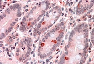 Anti-GNAT3 Antibody (A84445) (3.8µg/ml) staining of paraffin embedded Human Small Intestine. Steamed antigen retrieval with citrate buffer pH 6, AP-staining.