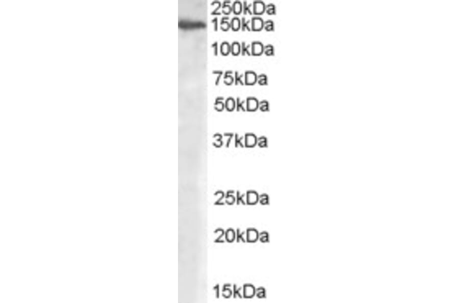 Western Blot - Anti-Mannosidase II/MAN2A1 Antibody (A84446) - Antibodies.com