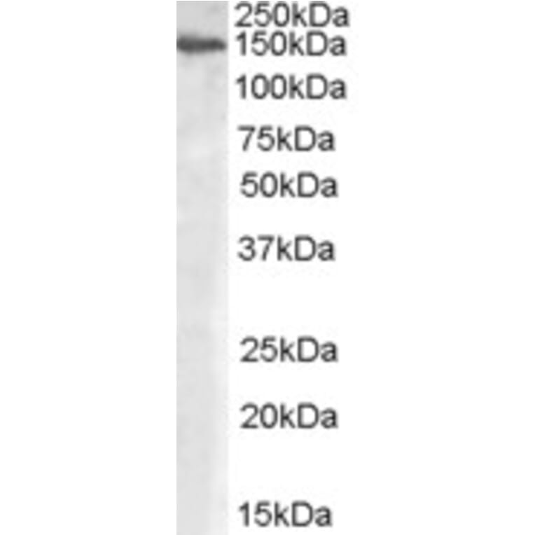 Western Blot - Anti-Mannosidase II/MAN2A1 Antibody (A84446) - Antibodies.com