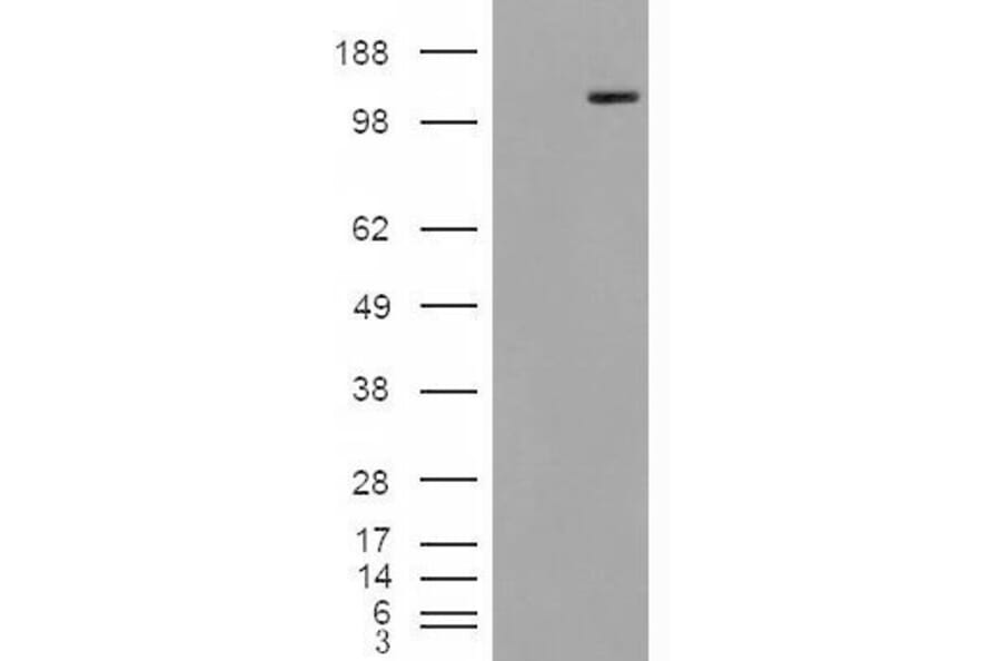 Western Blot - Anti-Mannosidase II/MAN2A1 Antibody (A84446) - Antibodies.com