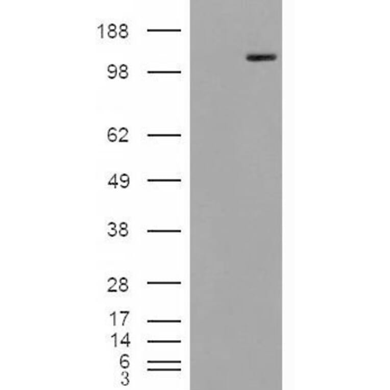 Western Blot - Anti-Mannosidase II/MAN2A1 Antibody (A84446) - Antibodies.com