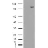 Western Blot - Anti-Mannosidase II/MAN2A1 Antibody (A84446) - Antibodies.com